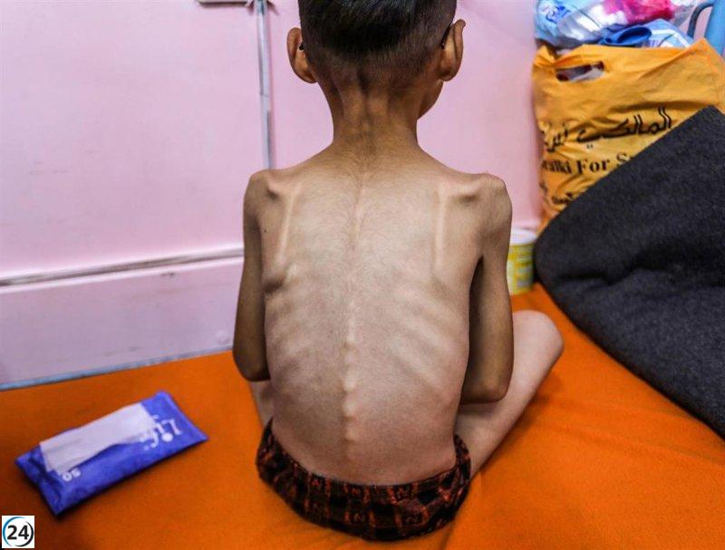 UNICEF advierte sobre alarmantes tasas de desnutrición infantil en Gaza durante el conflicto israelí.